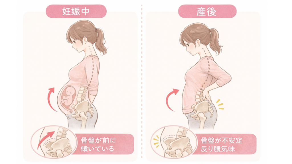 妊娠中は骨盤が前傾し、産後は骨盤が不安定になり反り腰気味になる様子を示した横向き比較イラスト